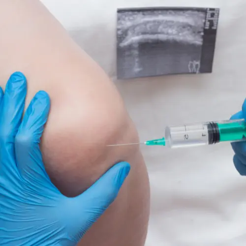 Steroid injections for joint or inflammation